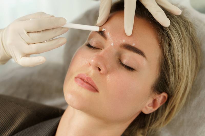 Botox et acide hyaluronique